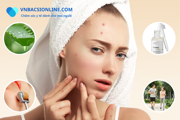 Những cách trị mụn hiệu quả nhất