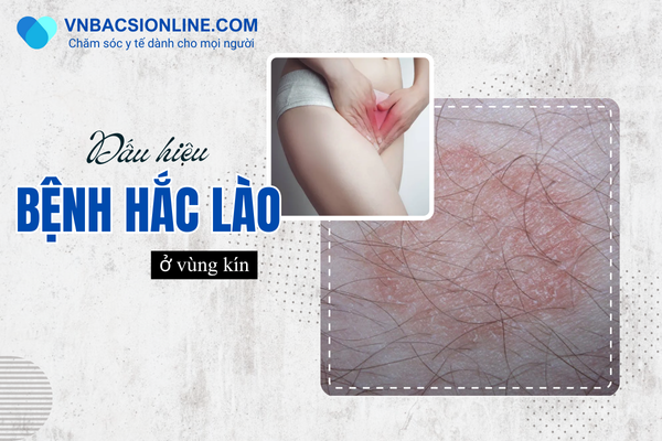 Bệnh hắc lào ở vùng kín có dấu hiệu gì trong giai đoạn đầu