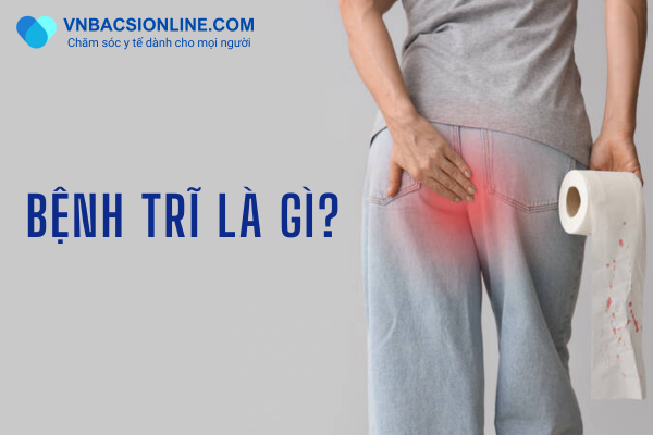Thuốc trị bệnh trĩ có điều trị dứt điểm được không?