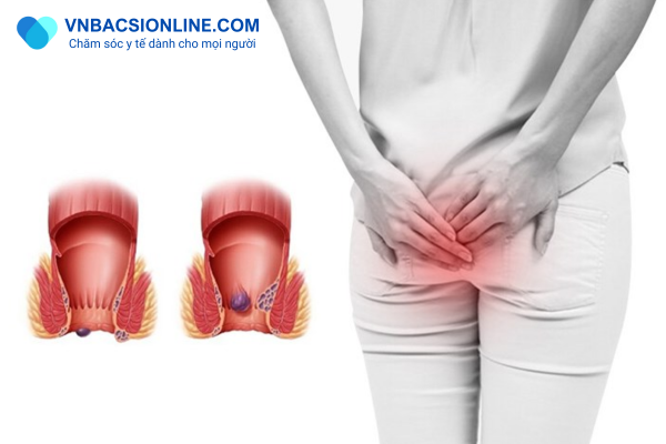 Những yếu tố ảnh hưởng đến thời gian lành vết thương