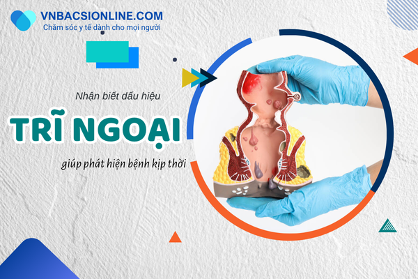 Dấu hiệu trĩ ngoại dễ nhận biết giúp điều trị kịp thời