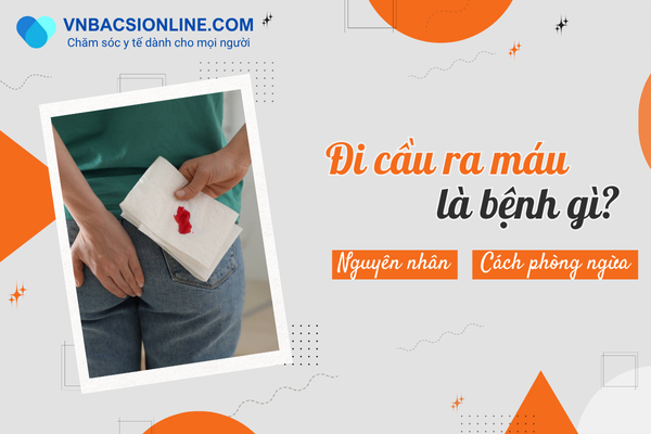 Đi cầu ra máu là bệnh gì? Giải đáp từ chuyên gia tiêu hóa