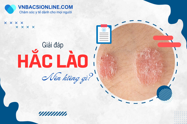 Những điều cần kiêng khi bị hắc lào để bệnh nhanh khỏi