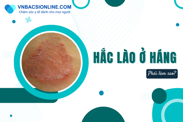 Chữa hắc lào ở háng dứt điểm và an toàn