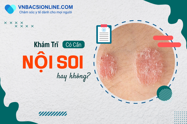 Khám trĩ có cần nội soi không? Tư vấn từ bác sĩ chuyên khoa