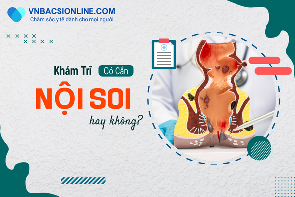 Khám trĩ cần nội soi không?