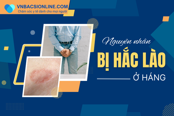 Nguyên nhân bị hắc lào ở háng phổ biến nhất hiện nay