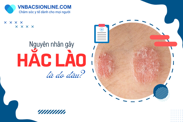 nguyen-nhan-bi-hac-lao.png
