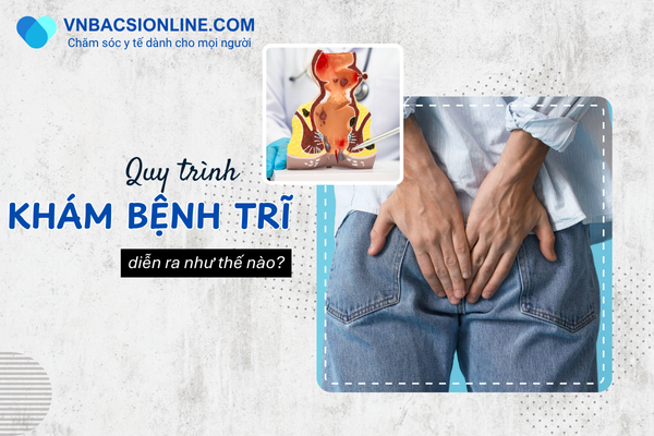 Quy trình khám trĩ hiện hành có gì thay đổi không?